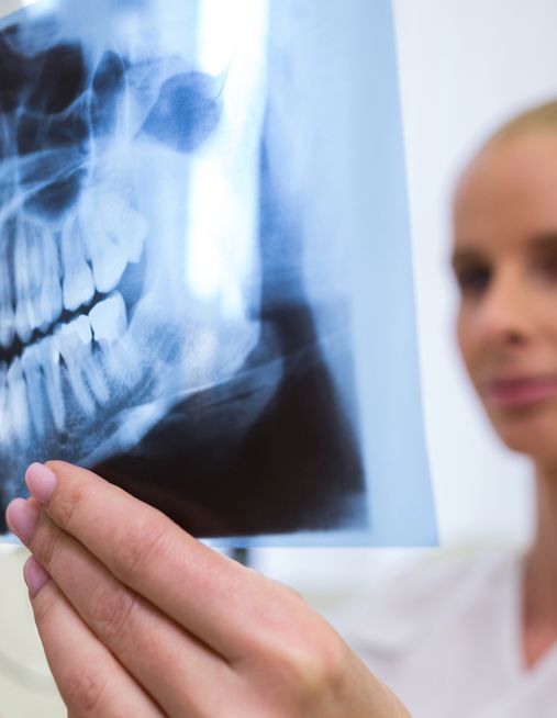 Fa male? Quanto dura? Quanto costa? Tutte le risposte sull’implantologia