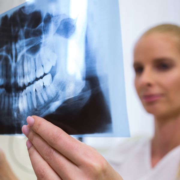 Fa male? Quanto dura? Quanto costa? Tutte le risposte sull’implantologia