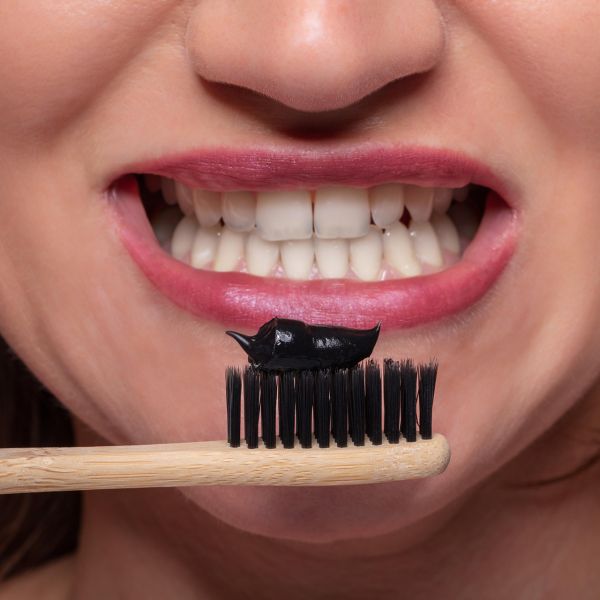 Sbiancamento dentale e “Moda del Whitening”: Quando il Trend diventa un rischio