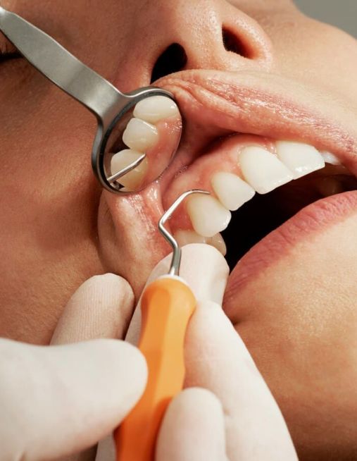 La Guida completa sulla Parodontologia
