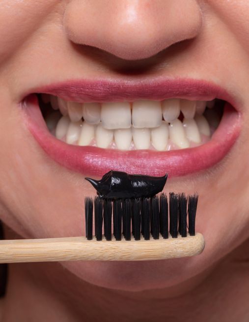 Sbiancamento dentale e “Moda del Whitening”: Quando il Trend diventa un rischio