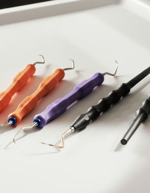 Endodonzia: la cura della polpa dentale