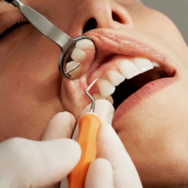 La Guida completa sulla Parodontologia